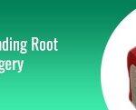 understanding root canel surgegy blog