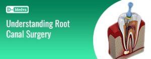 understanding root canel surgegy blog